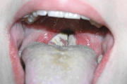 pilt