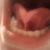 pilt